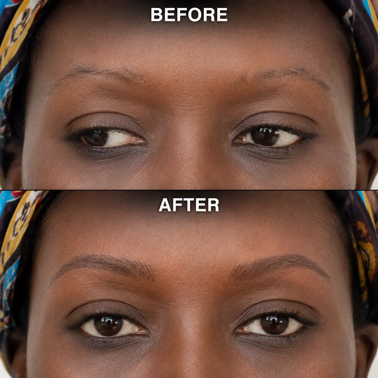 Before and after brow restoration result at Golden Brows