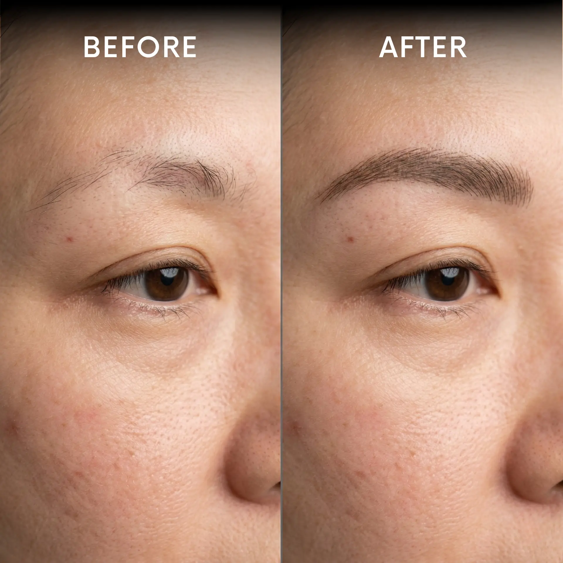 Before and after brow restoration result at Golden Brows